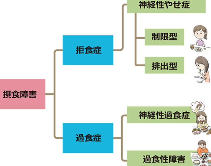 非嘔吐過食の原因と対処法について解説しま?